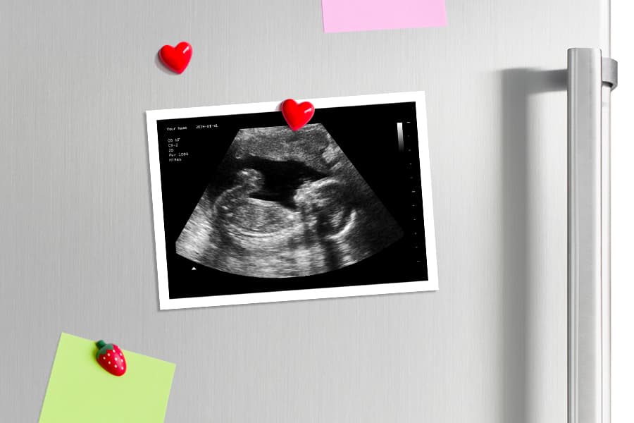 Baby Maybe - Fake Pregnancy Ultrasound Maker with Instant Digital Delivery