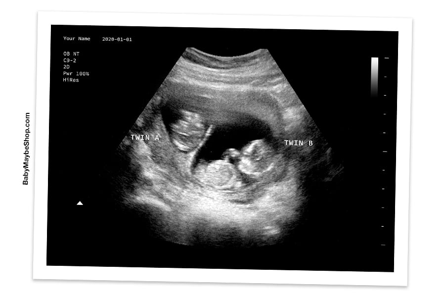 36 Top Pictures Fake Ultrasound App With Name - 8 Best Prank Apps of 2020 - DemotiX