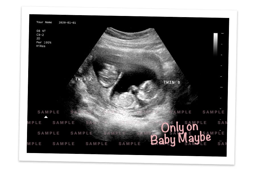 fake ultrasound sample pregnancy prank ultrasounds amazing create