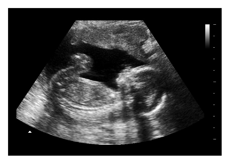 12 Weeks Fake Ultrasound