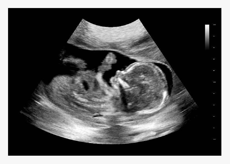 16 Weeks Fake Ultrasound