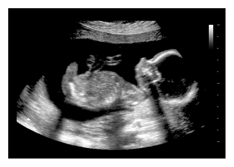 20 Weeks Fake Ultrasound