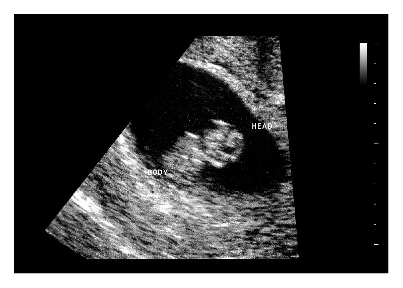 8 Weeks Fake Ultrasound