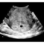 4-Weeks 2d Ultrasound - Digital PDF