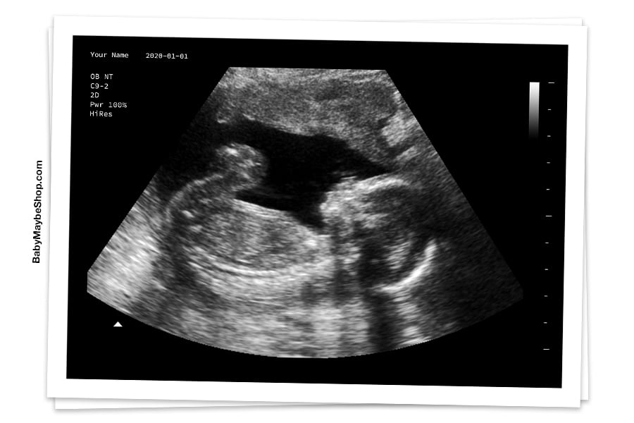 An ultrasound from the Baby Maybe Premium Fake Ultrasound Shop
