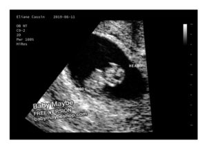 A fake ultrasound example from Baby Maybe