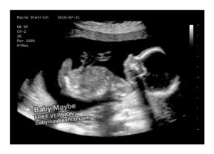 A fake ultrasound example from Baby Maybe
