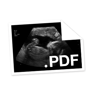 Customize Fake Ultrasounds and Fake Sonograms | Baby Maybe