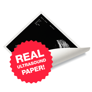 One real Ultrasound paper photo, printed and mailed