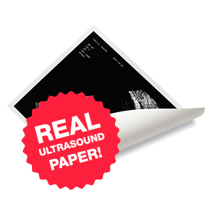One real Ultrasound paper photo, printed and mailed