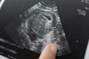 A finger pointing at a fake ultrasound