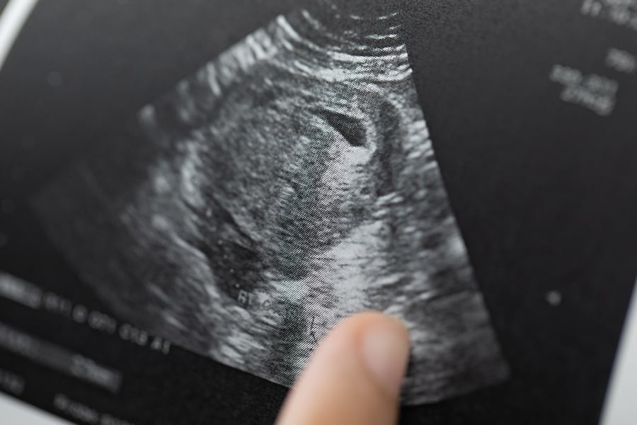 A finger pointing at a fake ultrasound