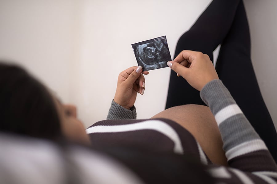 A pregnant woman holding an ultrasound