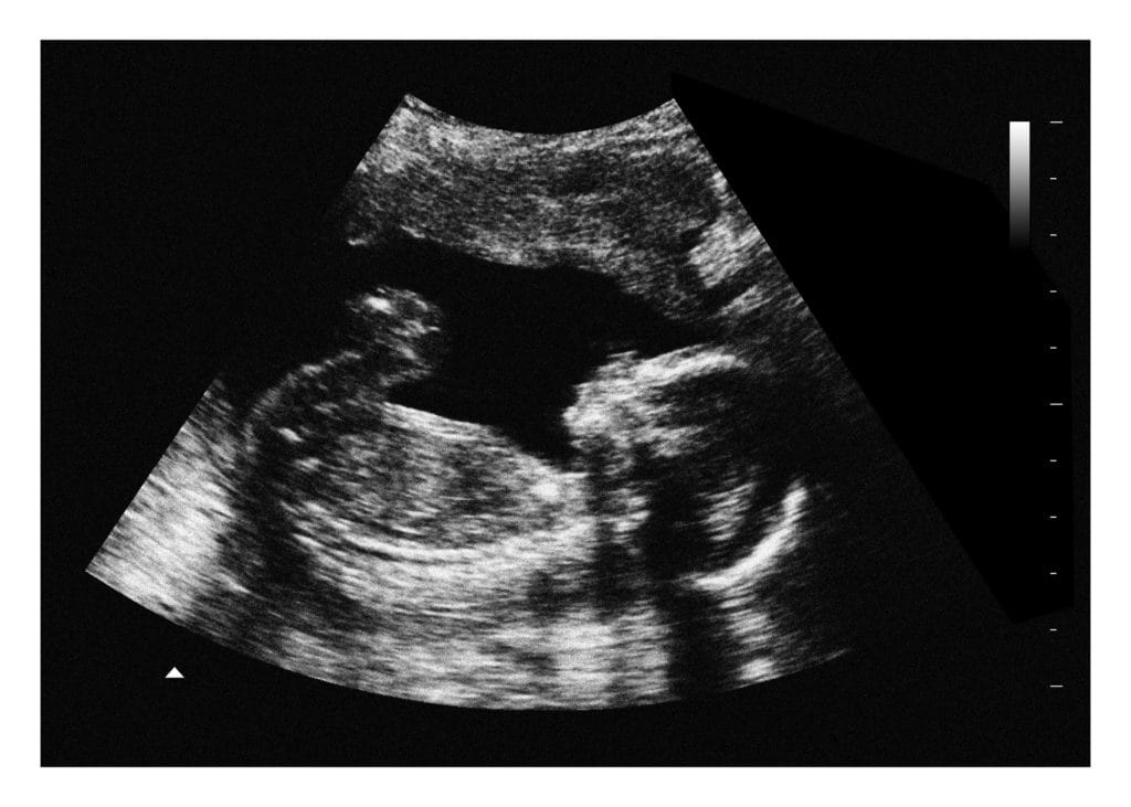 12 Weeks Fake Ultrasound Image