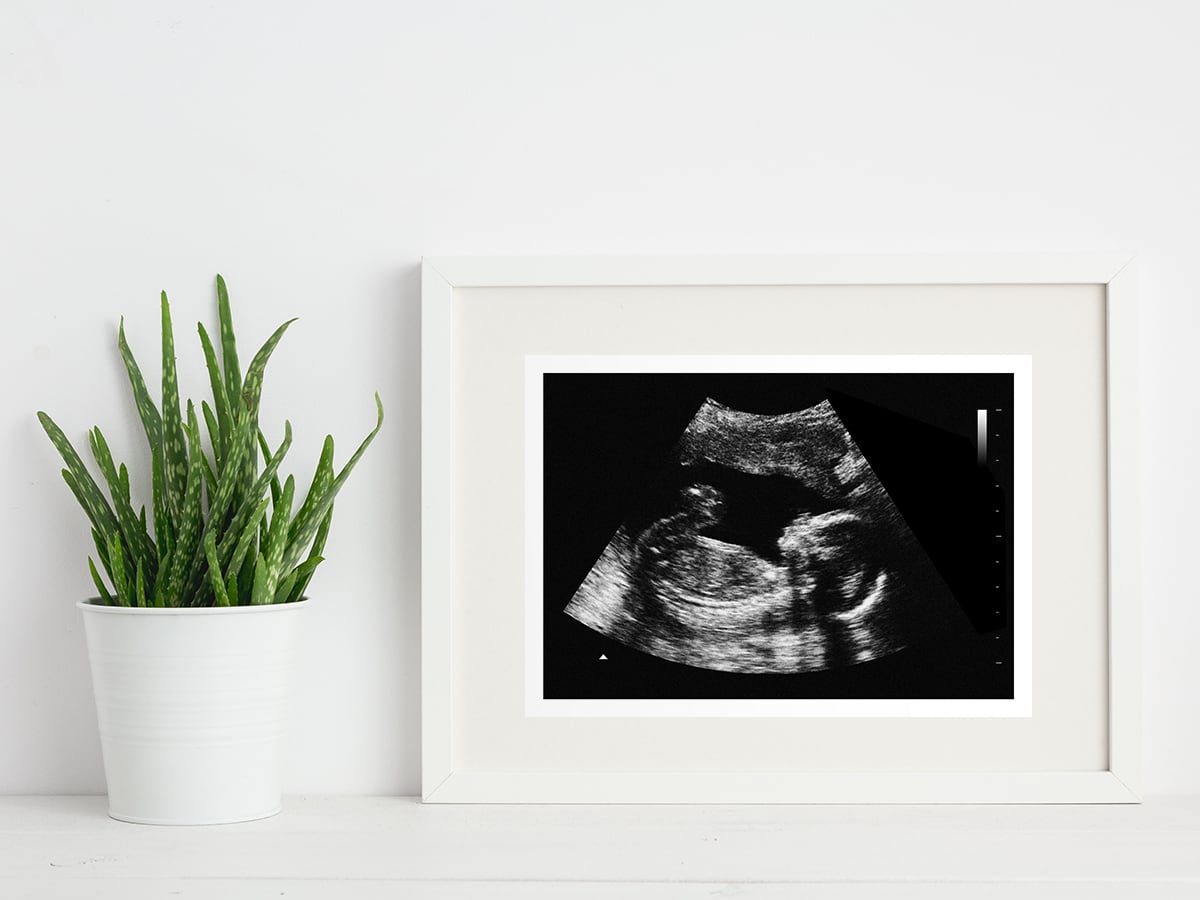 12 week ultrasound in a frame