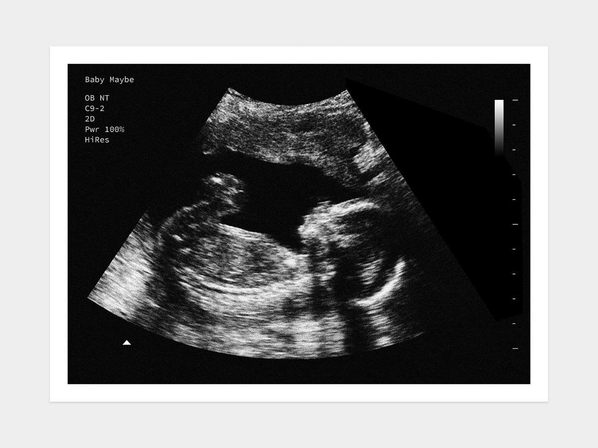 Girl 12 week  Fake sonogram baby Personalized Pozitive Pregnancy prank fake baby