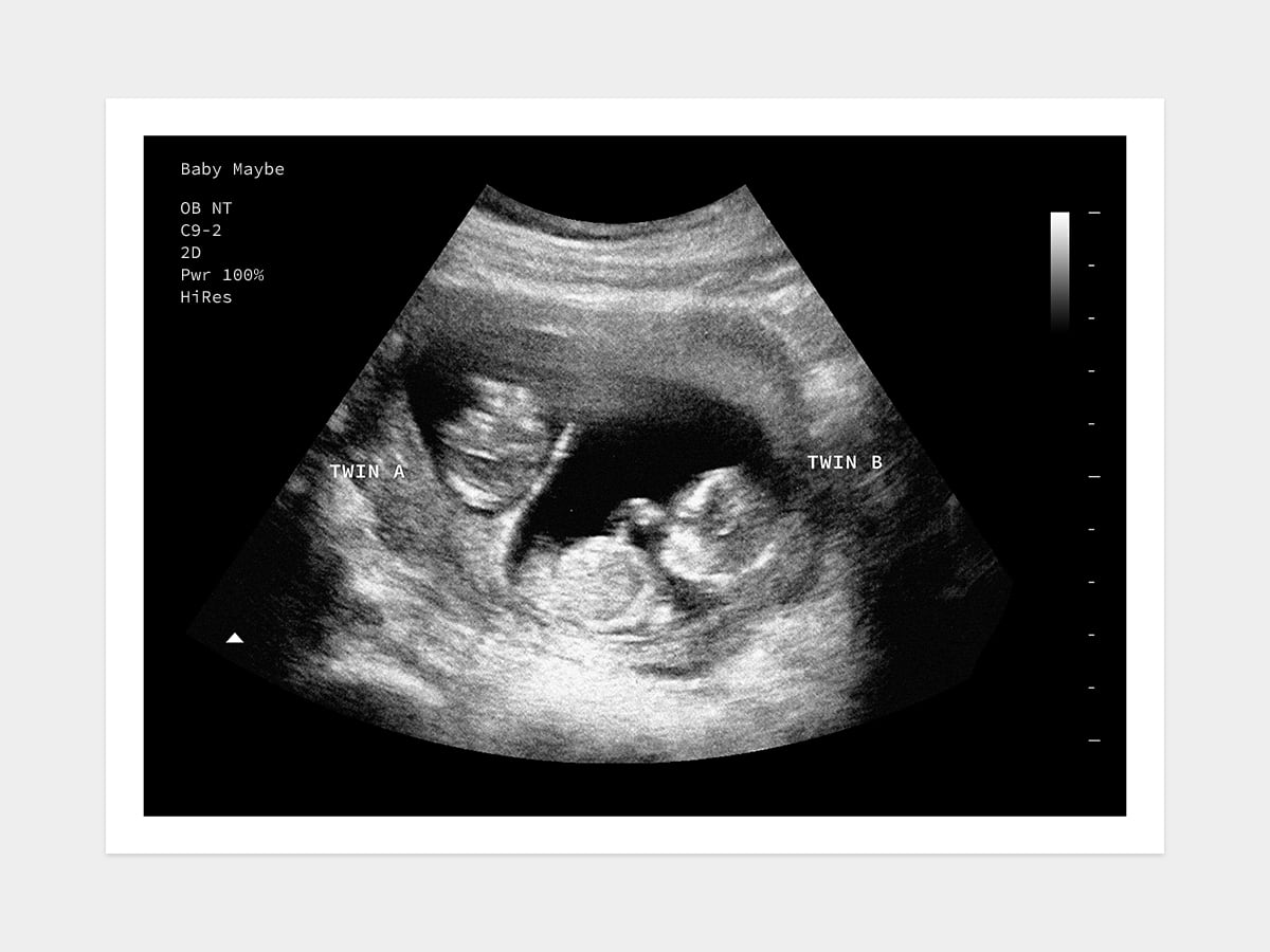 12 Weeks Twins Fake Ultrasound Image