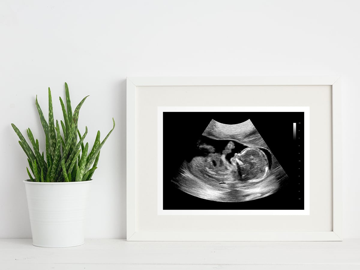 16 week ultrasound in a frame