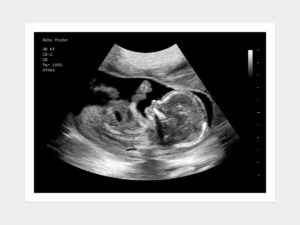 16 Weeks Fake Ultrasound Image