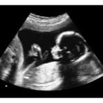 20 Weeks Fake Ultrasound Image