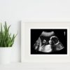 20 week ultrasound in a frame
