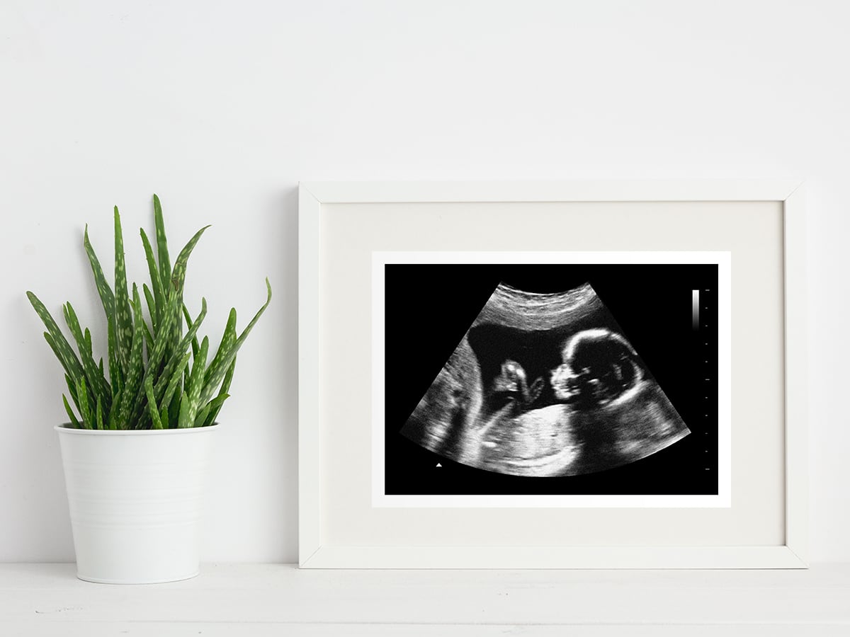 20 week ultrasound in a frame