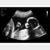 20 Weeks Fake Ultrasound Image