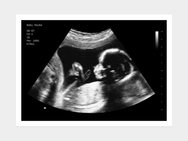 20 Weeks Fake Ultrasound Image