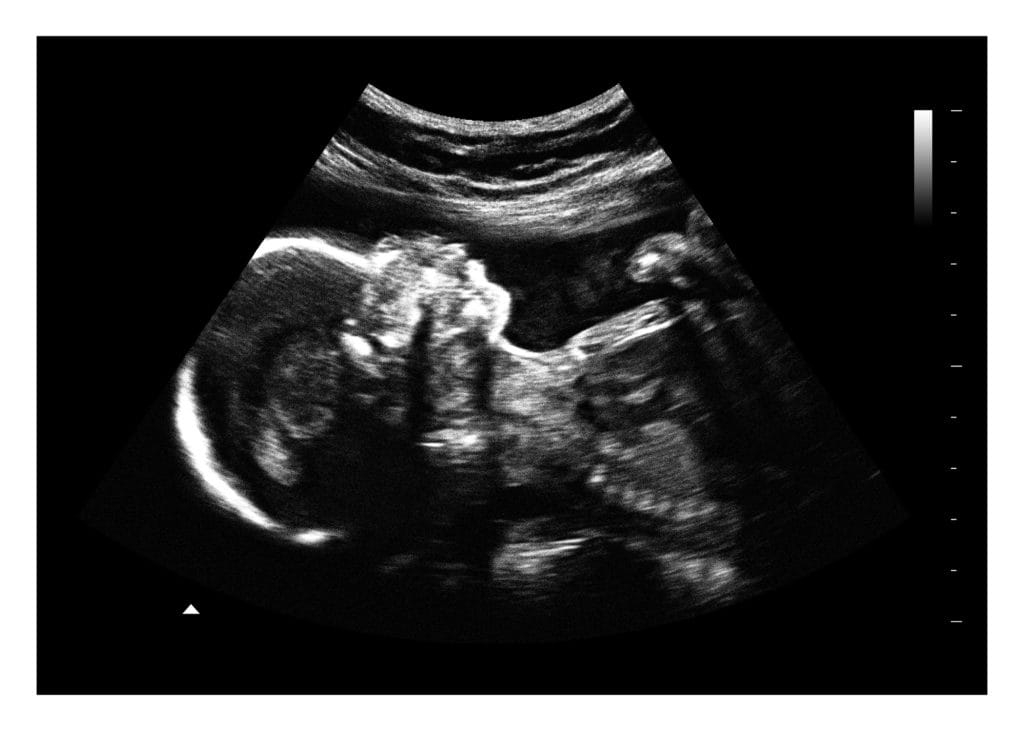24 Weeks Fake Ultrasound Image