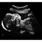 24-Weeks 2d Ultrasound - REAL Thermal Print + PDF