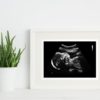 24 week ultrasound in a frame