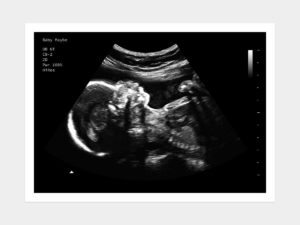 24 Weeks Fake Ultrasound Image