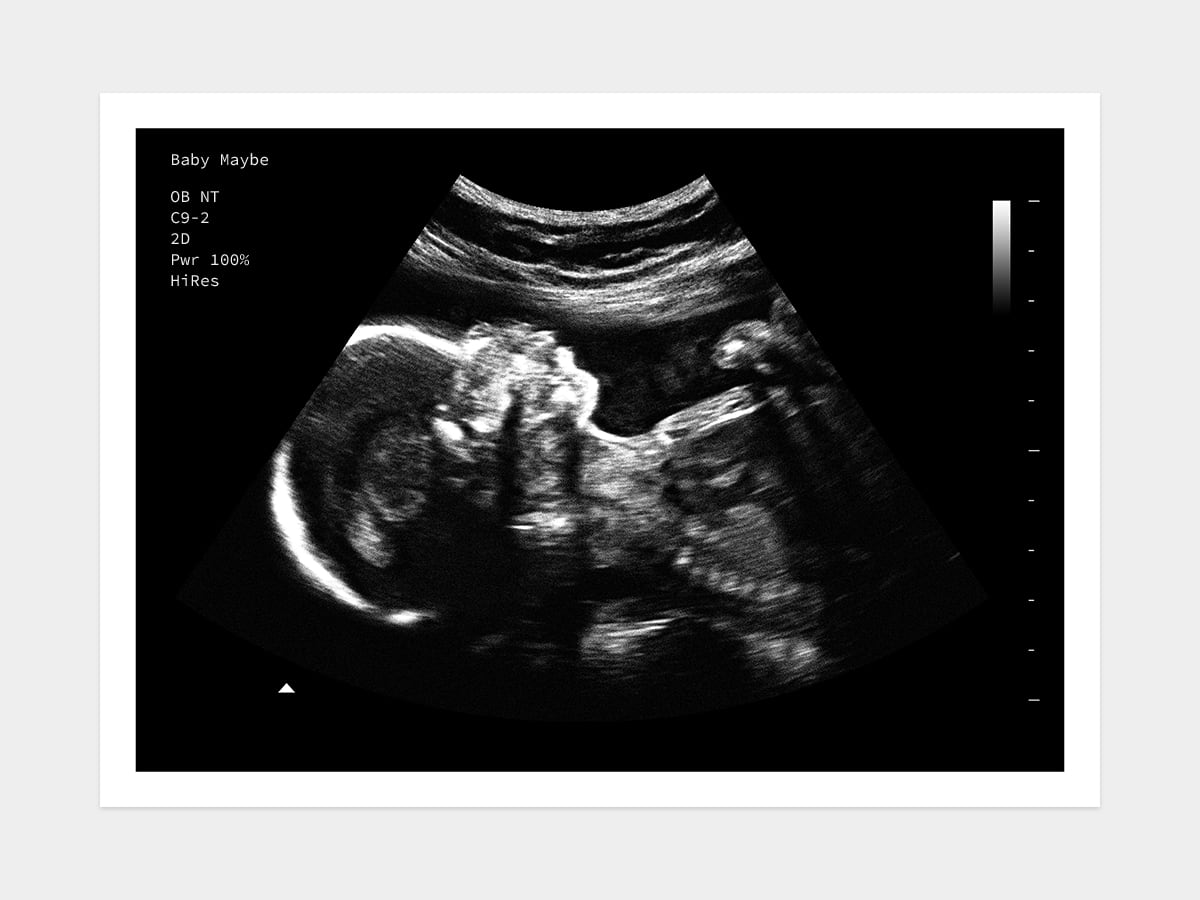 24 Weeks Fake Ultrasound Image