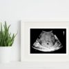 4 week ultrasound in a frame