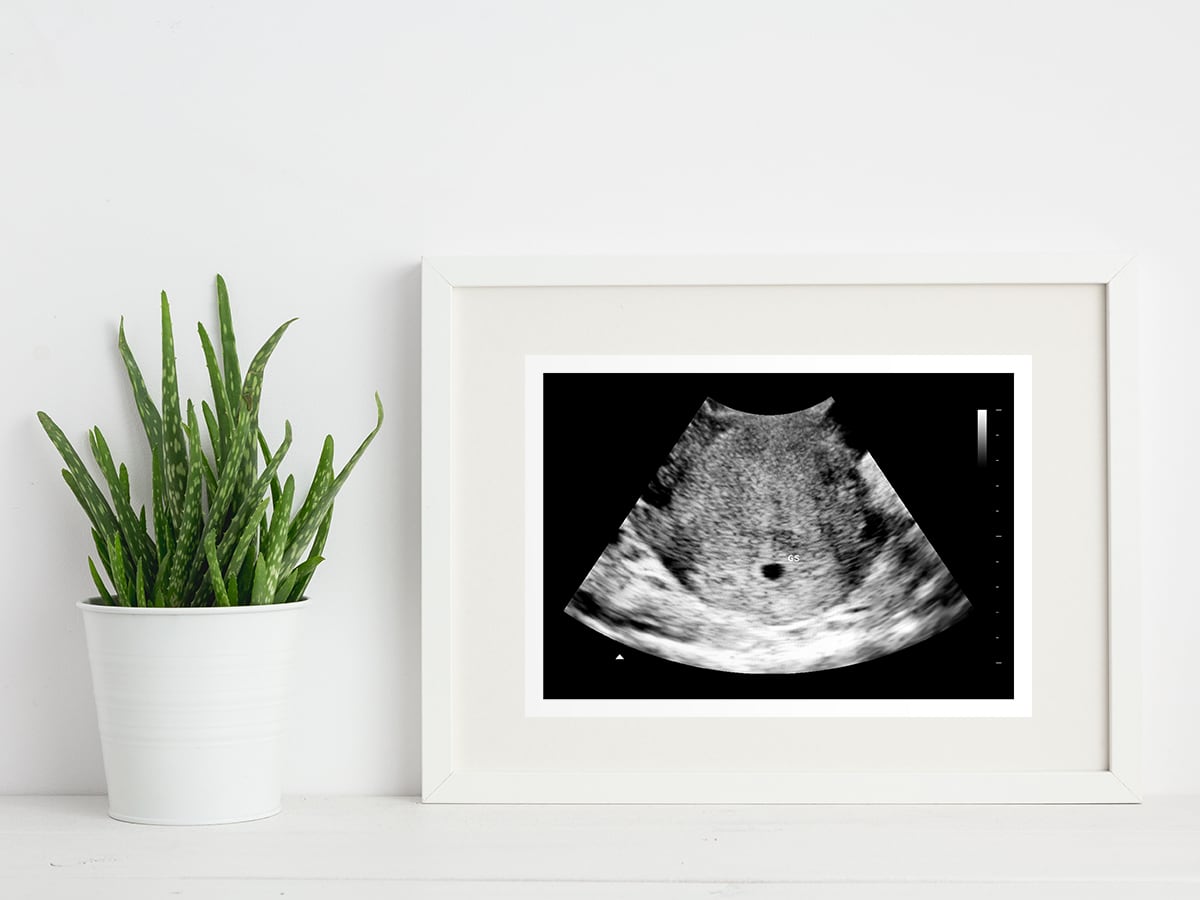 4 week ultrasound in a frame