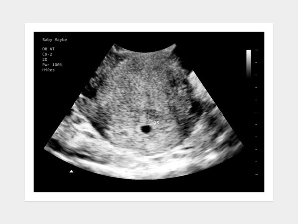 4 Weeks Fake Ultrasound Image