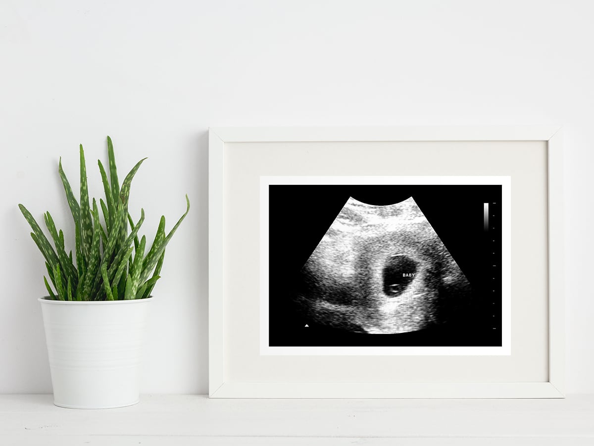 5 week ultrasound in a frame
