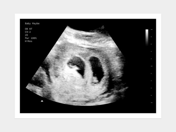 5 Weeks Twins Fake Ultrasound Image