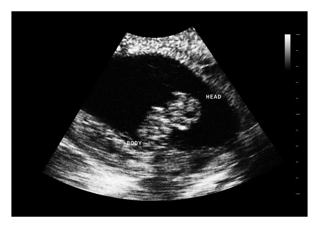 8 Weeks Fake Ultrasound Image