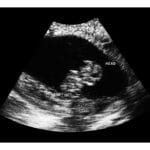 8 Weeks Fake Ultrasound Image