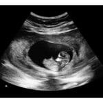 8 Weeks Fake Ultrasound Image
