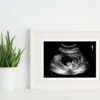 8 week ultrasound in a frame