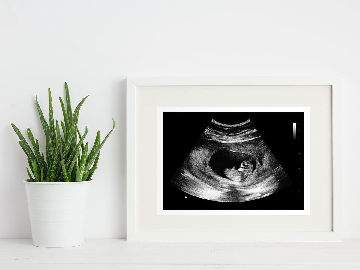 8 week ultrasound in a frame