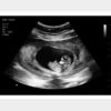 8 Weeks Fake Ultrasound Image