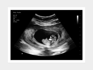 Prank Ultrasound Baby Scan Photo Pregnancy Joke Personalised Custom PRINTED 