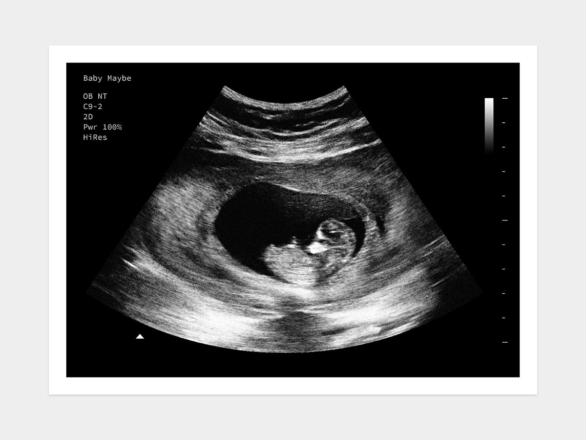 8 Weeks "Little Bean" | Fake Ultrasound w/ Instant Download!