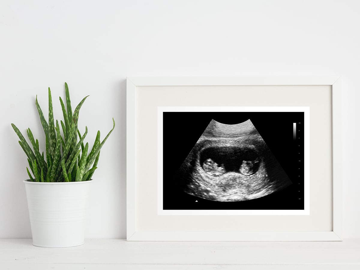 8 week twins ultrasound in a frame