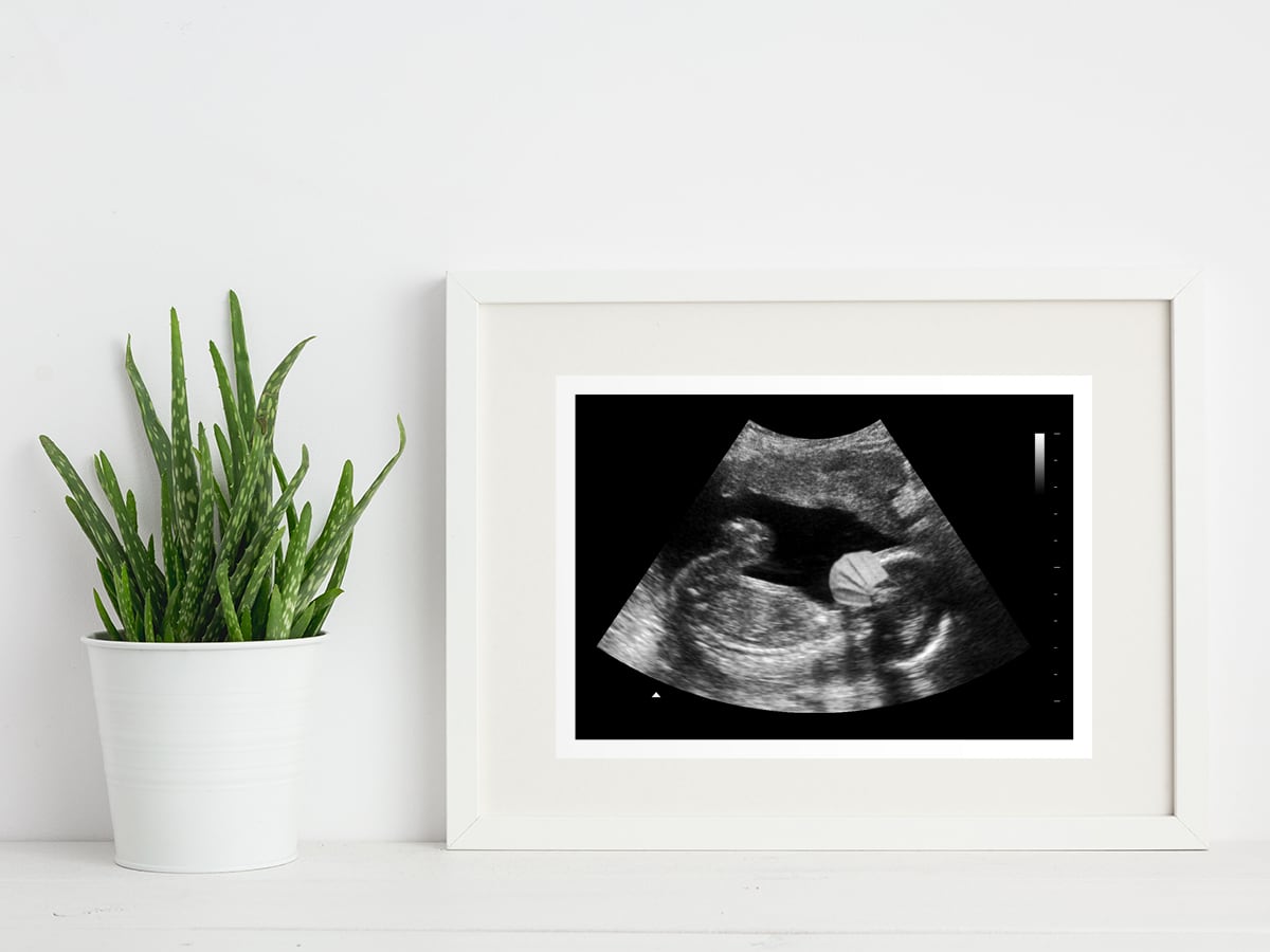 Covid Baby Fake Ultrasound in a frame