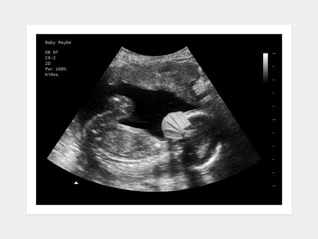 Covid Baby Fake Ultrasound Image