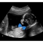 Blue Bowtie Gender Reveal Fake Ultrasound
